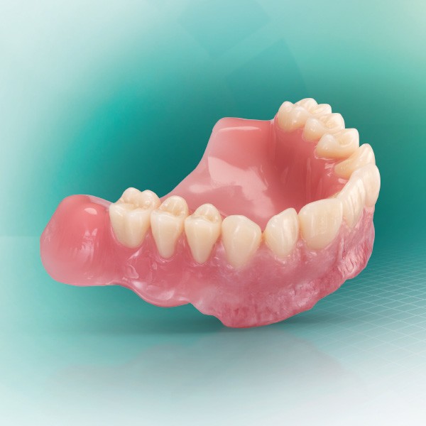Eine digital gefertigte Oberkiefer-Prothese aus VITA VIONIC Systemkomponenten